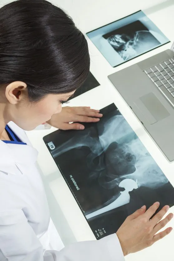 A hip model used to explain a procedure