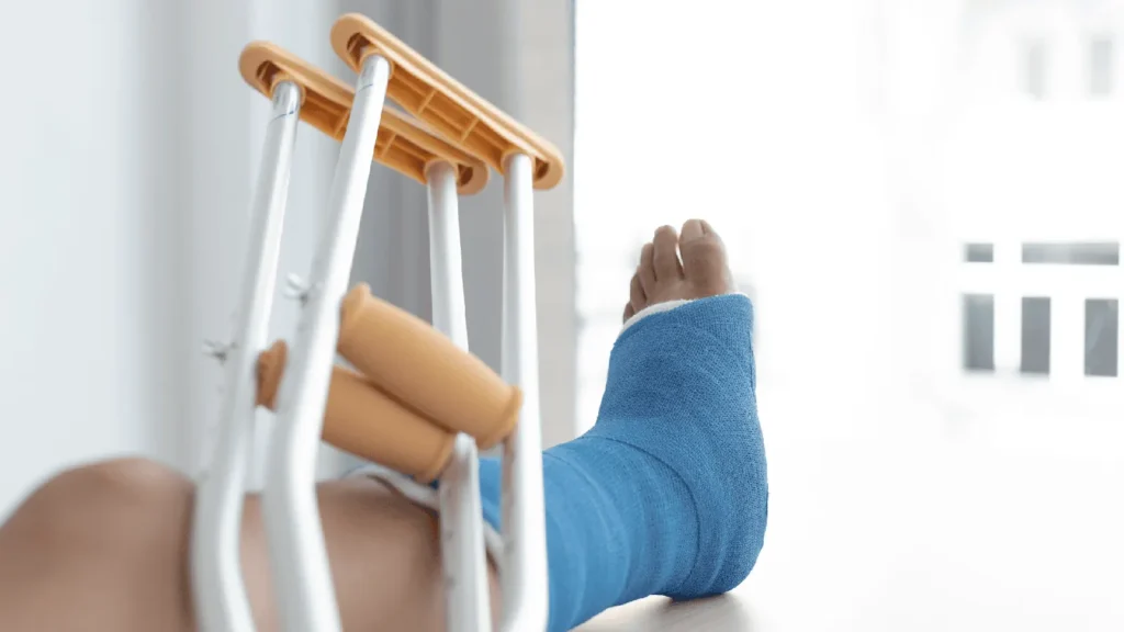 An injured foot in a blue cast and crutches propped up on a table as a patient recovers. 